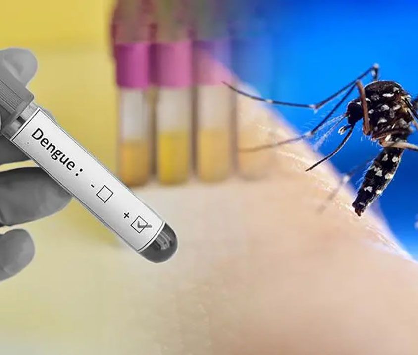 dengue-il-virus-viaggia-con-le-zanzare